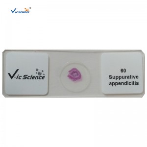 100pcs πακέτα ανθρώπινης παθολογίας μικροσκοπικά προετοιμασμένα διαφάνειες