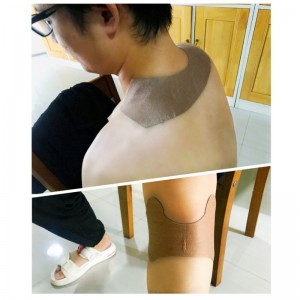 Πάσσαλο ανακούφισης του πόνου