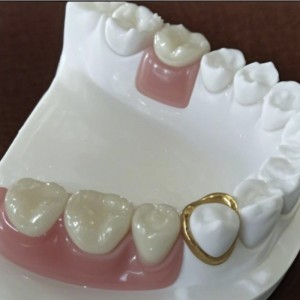 Προσκόλληση ακριβείας