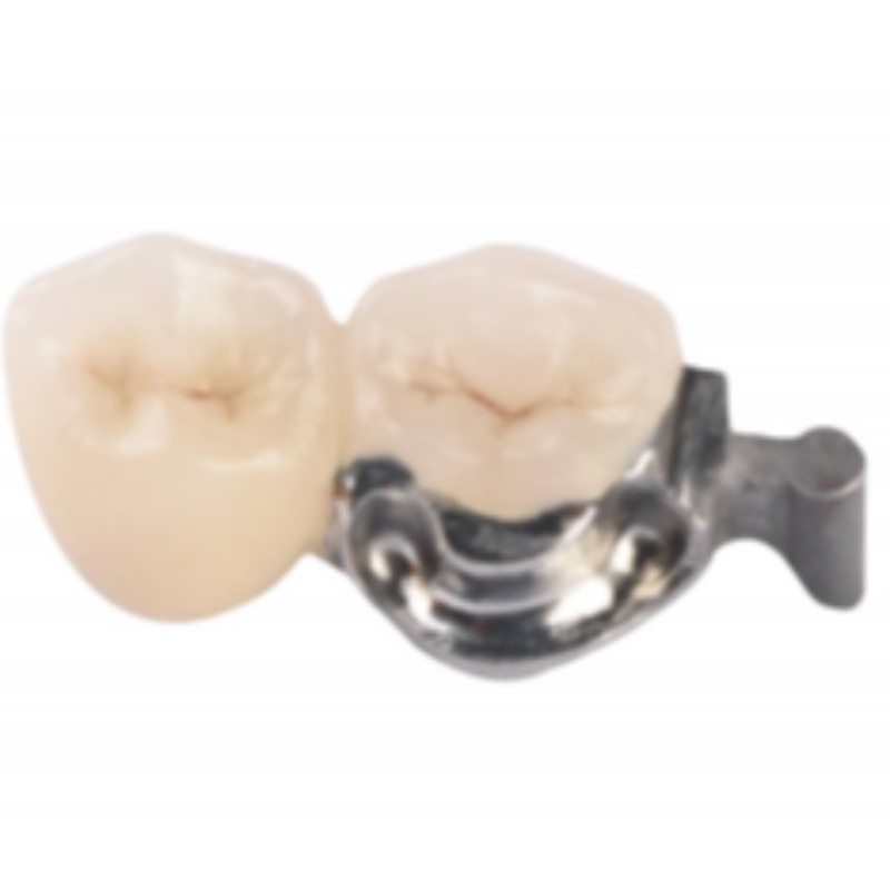 Προσκόλληση ακριβείας